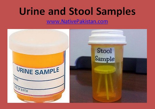 Doctor Humor - Urine & Stool Samples - Funny Doctor Jokes - Medical Jokes