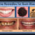 Home Remedies for Gum Disease